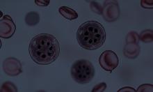 malaria 